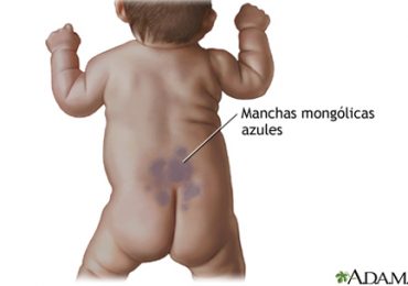 Manchas mongólicas: o que são e quando desaparecem?